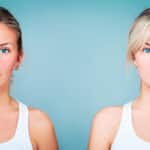 Skin before and after diet