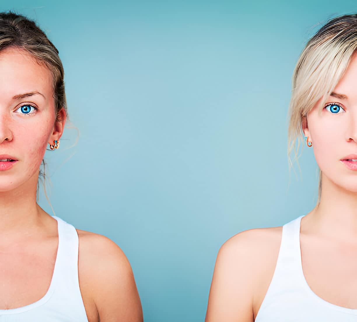 Skin before and after diet