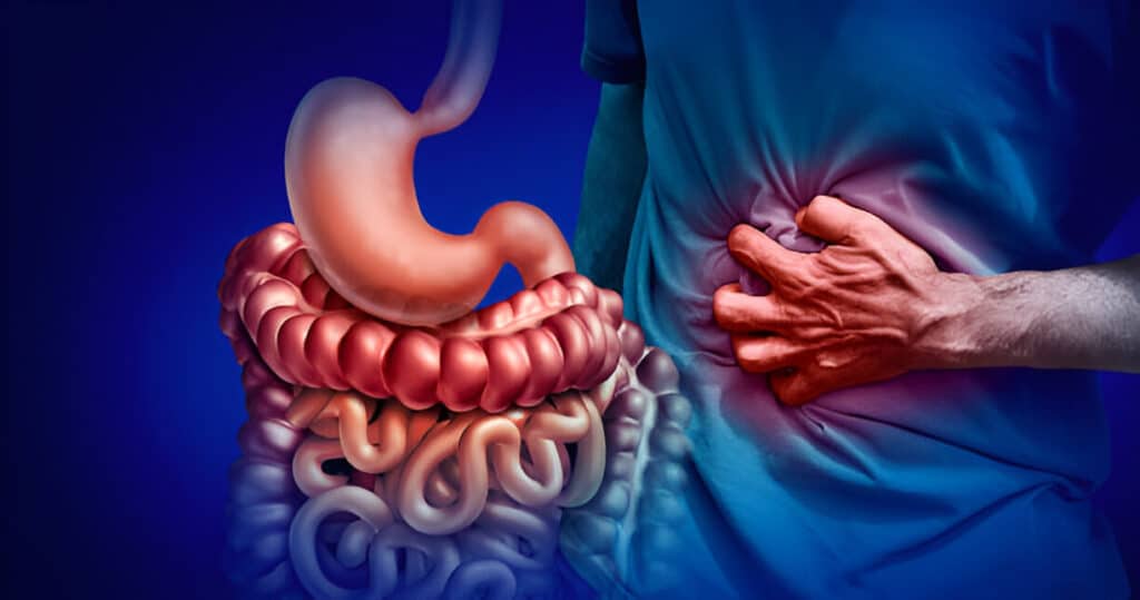 Can Coffee Cause Bloating