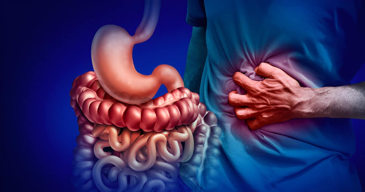 Can Coffee Cause Bloating